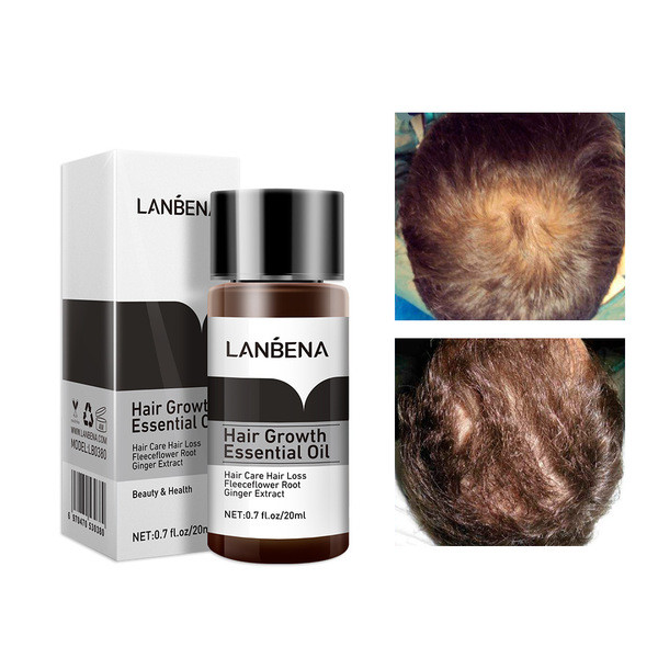 Lanbena Hair Growth Essential Oil