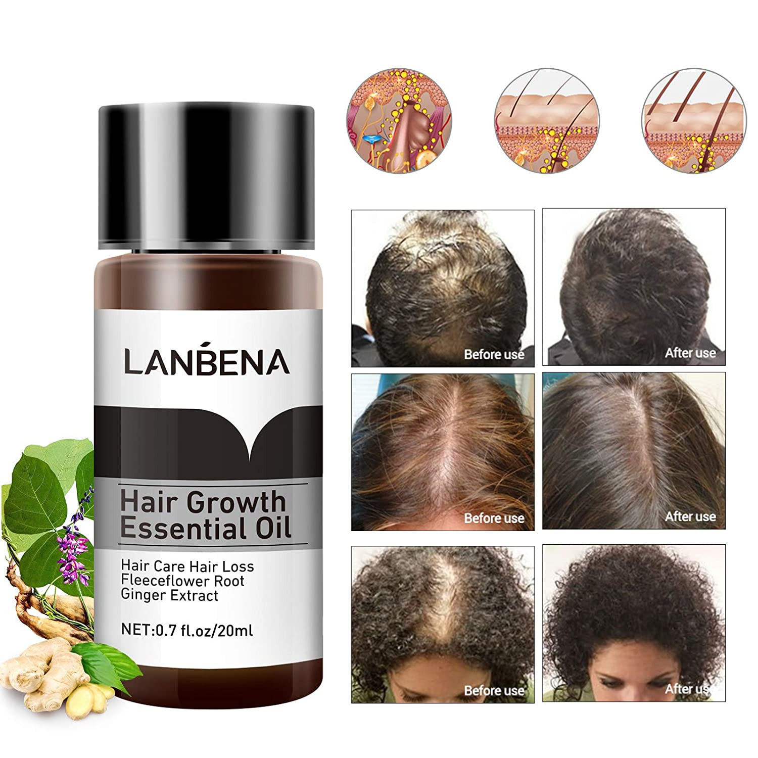 Lanbena Hair Growth Essential Oil