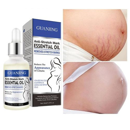 Guanjing Anti-Stretch Mark Essential Oil - 30ml