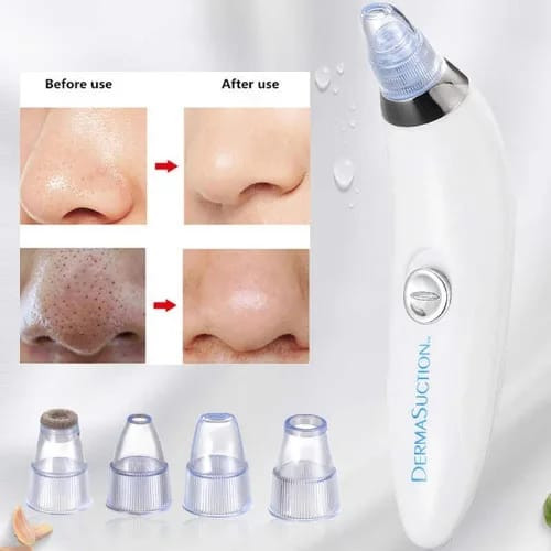 DermaSuction