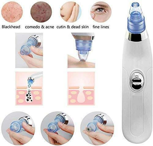 DermaSuction